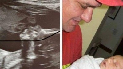 Grávida vê o pai, falecido, em exame de ultrassom, repetindo foto de 2009