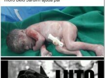 Exclusivo: Mulher acusa Hospital de Belo Jardim de negligência que culminou na morte do seu bebê