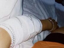 Menina foi agredida a golpes de estilete em Cachoeirinha — Foto: Reprodução/Arquivo pessoal